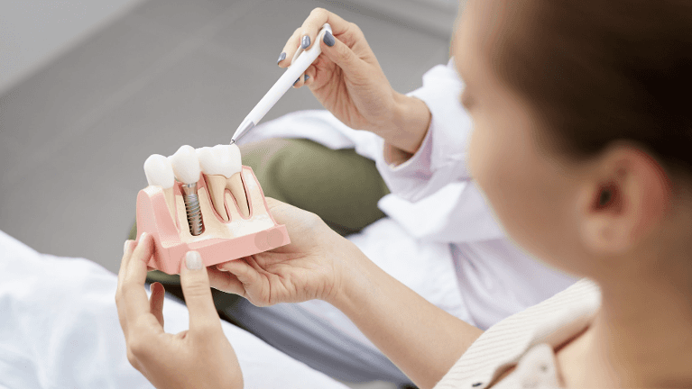 a model of a Dental Implant in Audubon, NJ 