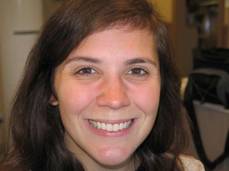 audubon nj clear braces