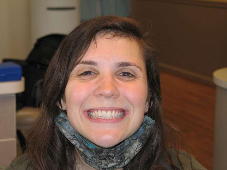 invisalign in audubon nj