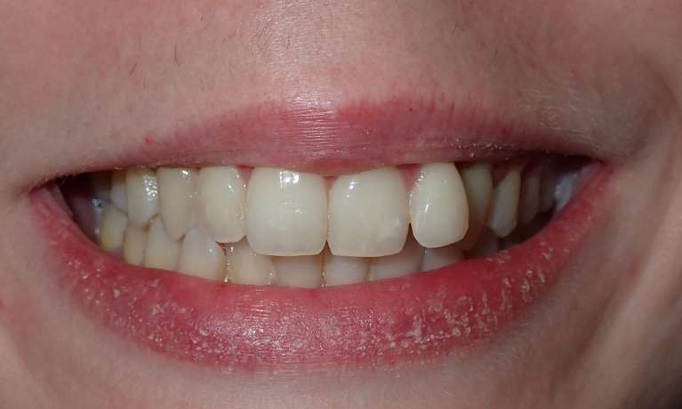 Before-Our patient was always aware of her